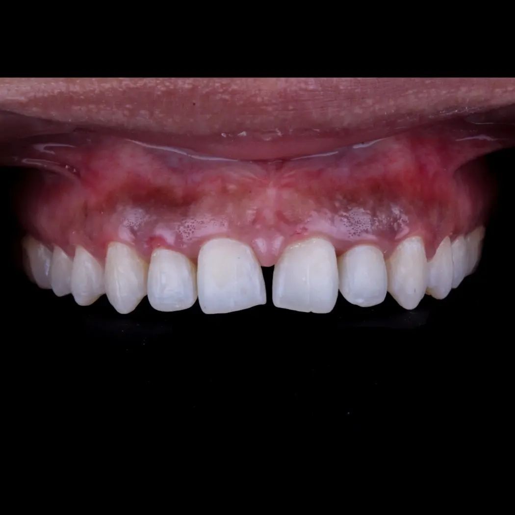 Hugo Enrique Aguilar Lamas-53