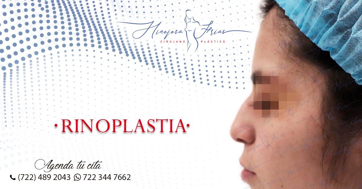 Miguel Ángel Hinojosa Frías-4