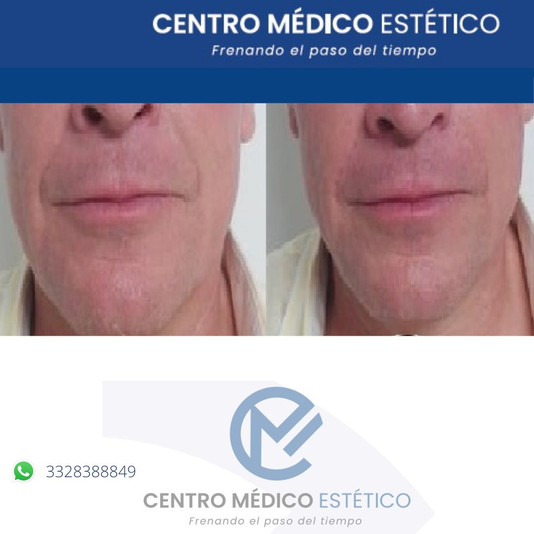 Sergio Alejandro Cerda Mendoza-11