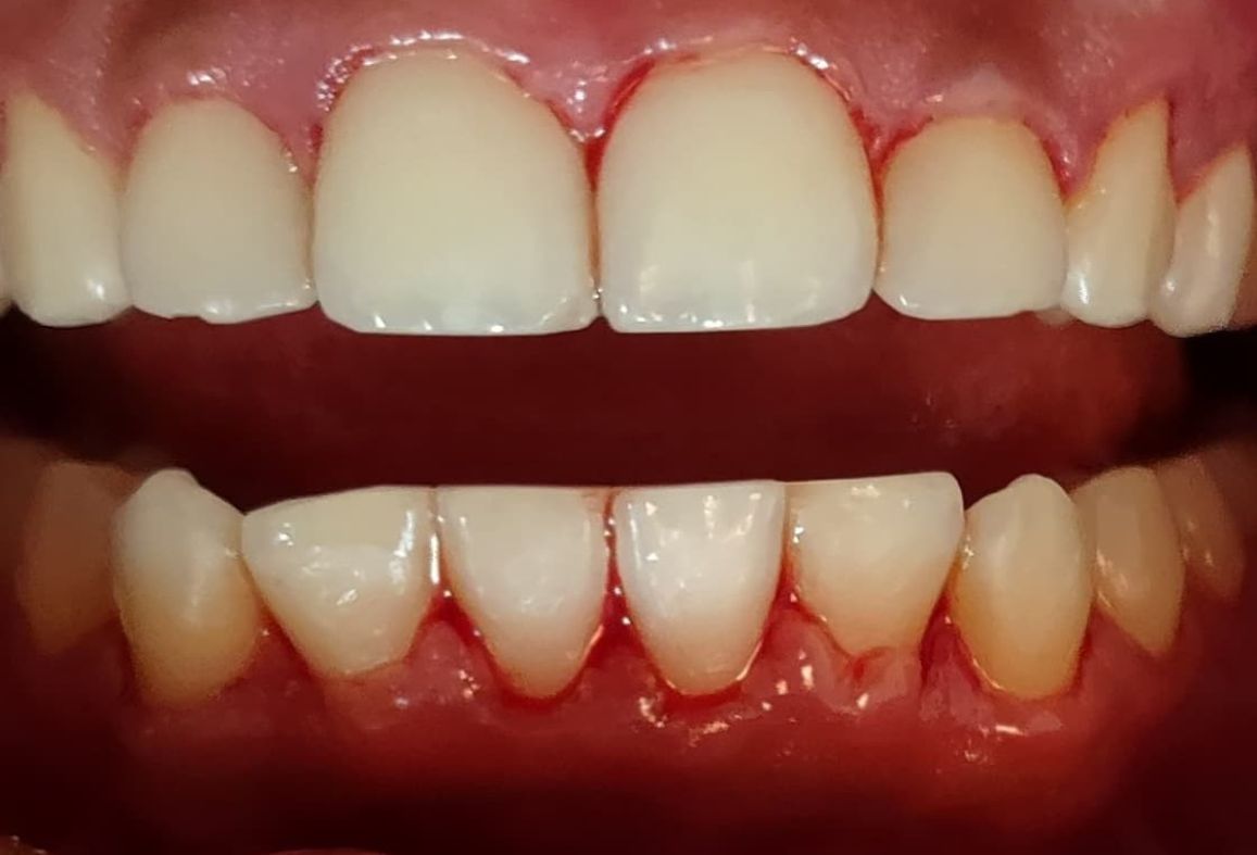 Rosa Isabel Lara Román-3