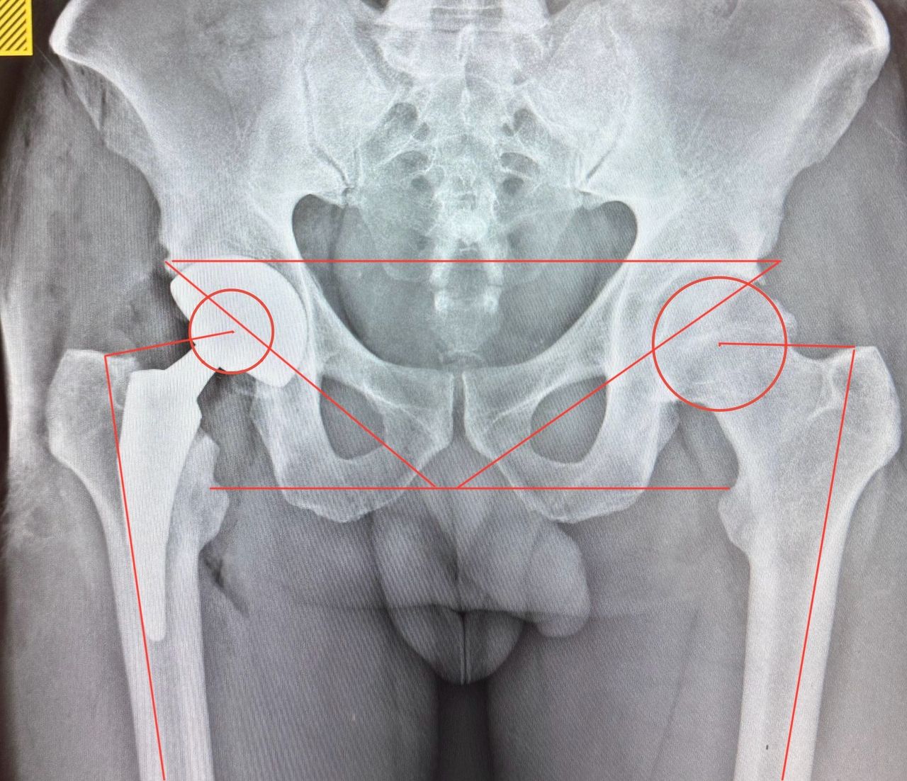 Alejandro Martínez Ramírez-46