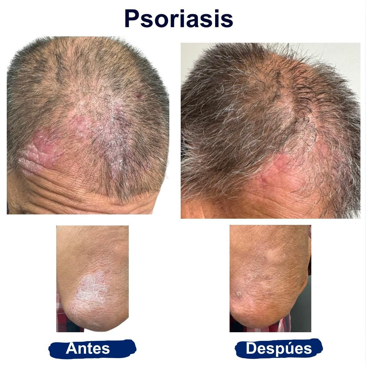 Itzel Anayn Flores Reyes-27