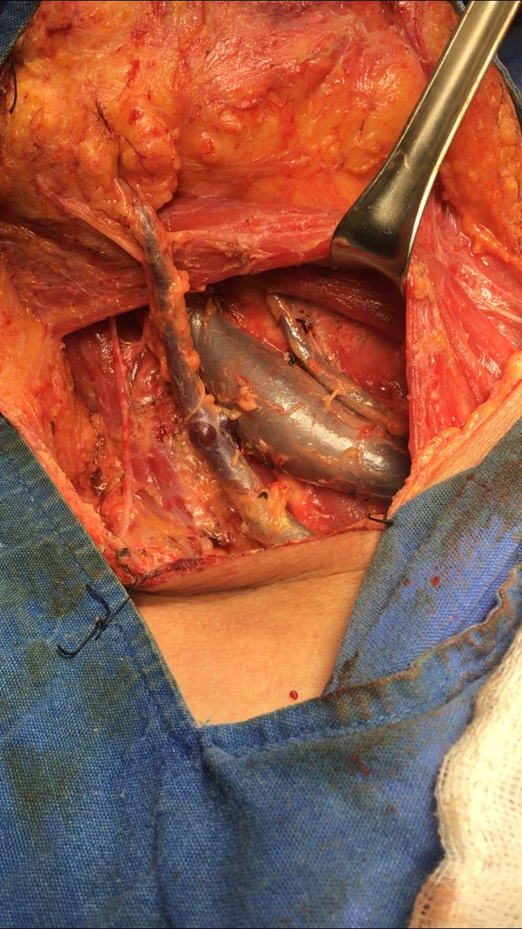 César Espejel Valdés-32