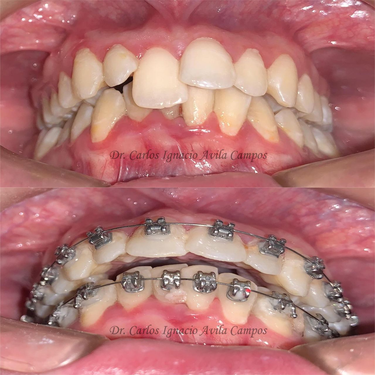 Carlos Ignacio Avila Campos-17