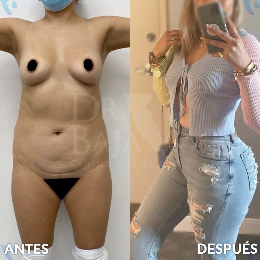 Renato Rodríguez Hirales-12