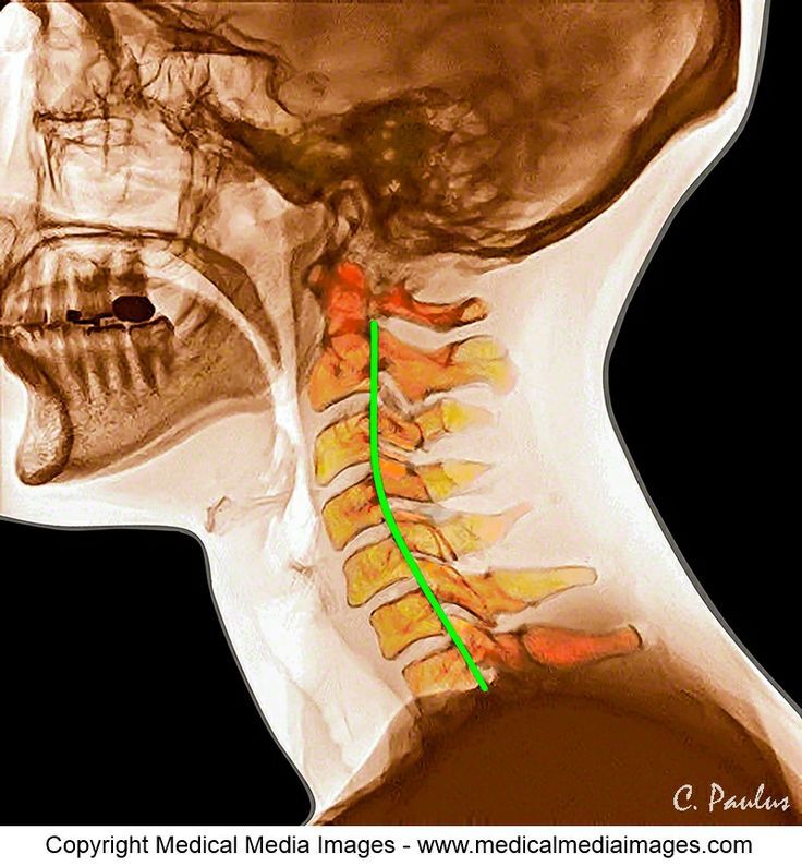 José Sayavedra Jaimes-38