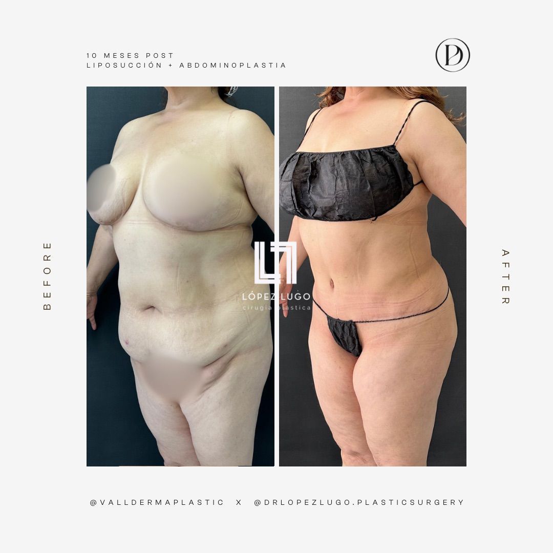 Omar Federico López Lugo-15