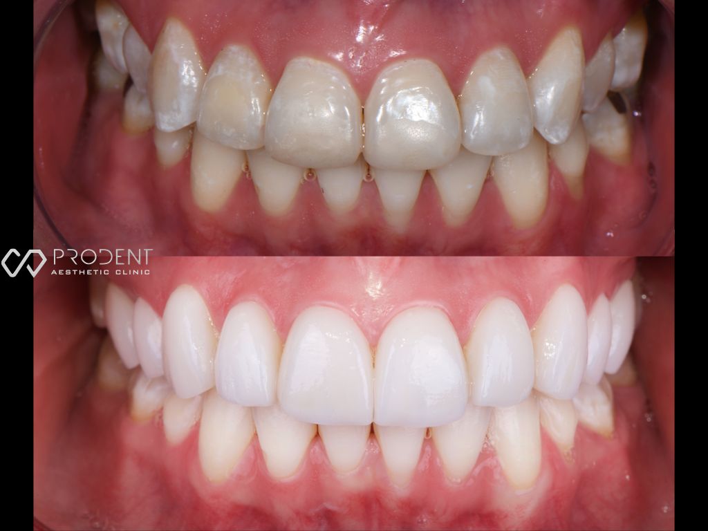 Ulises Pérez Murillo-78