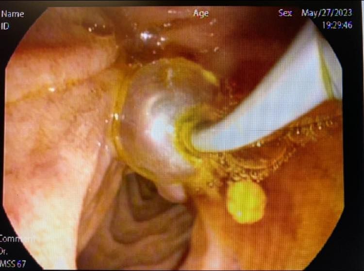 J. César Reyes Vásquez-9