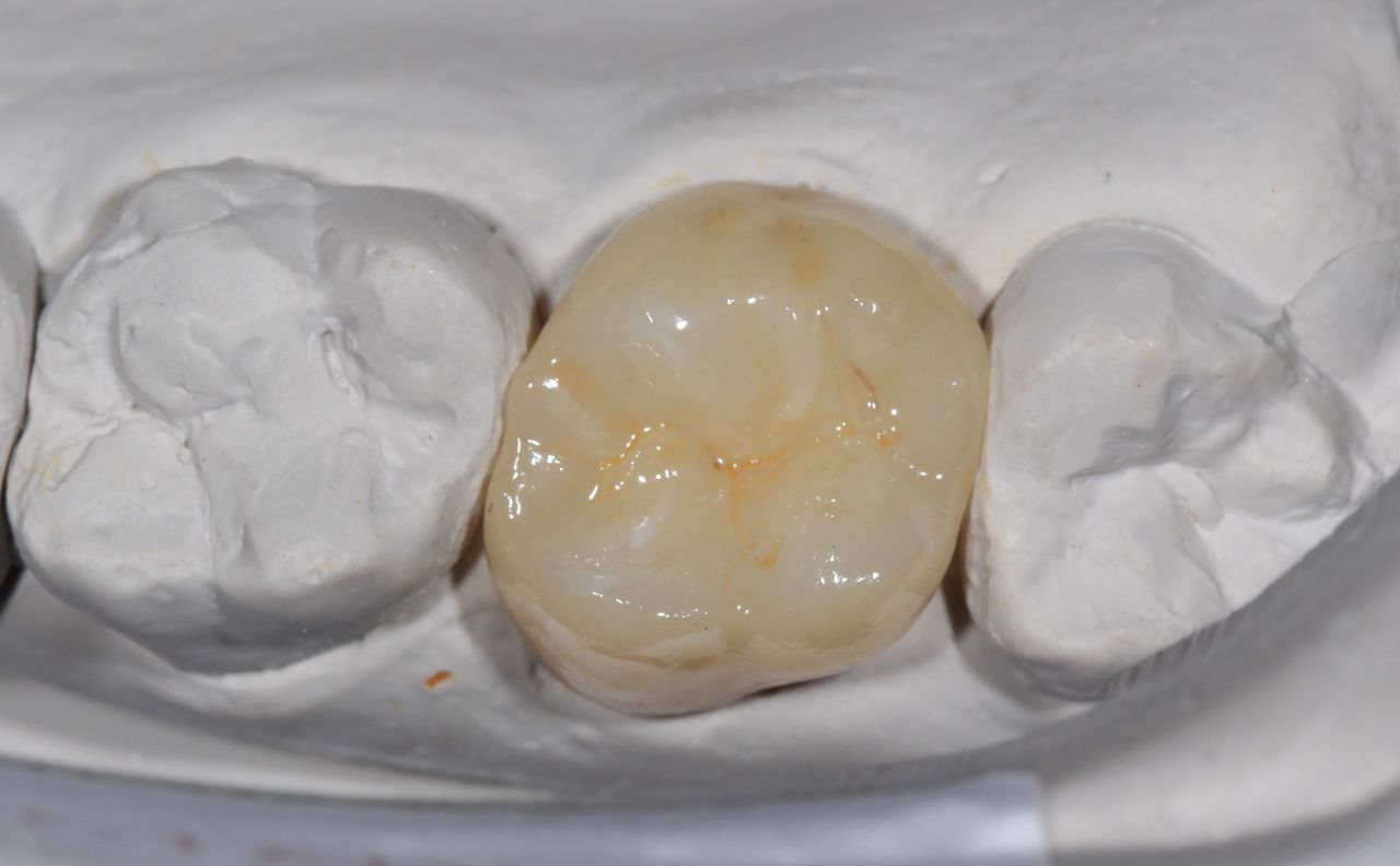 Jesus De La Cruz Ballinas-35