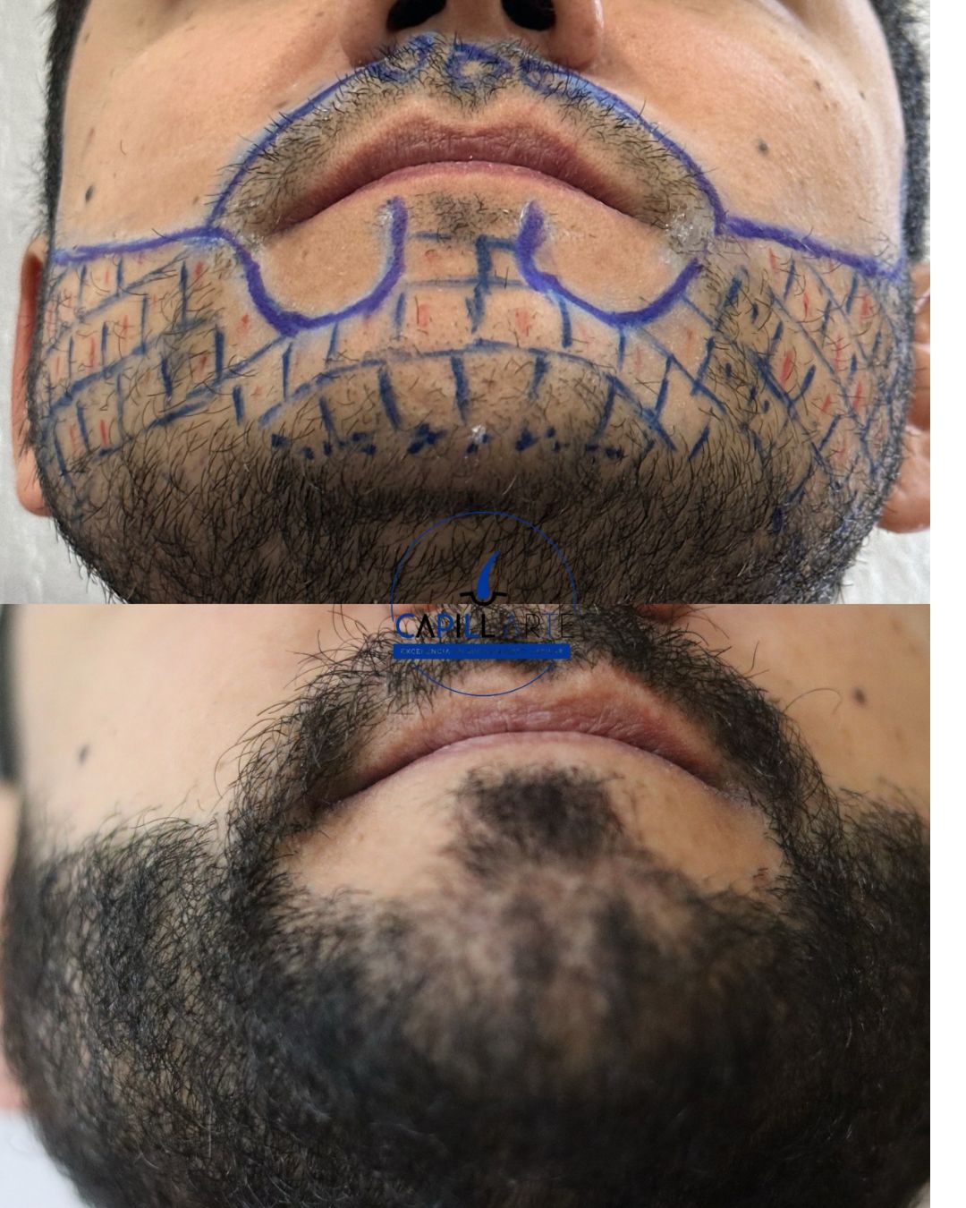 Adrian Hernandez Lopez-14