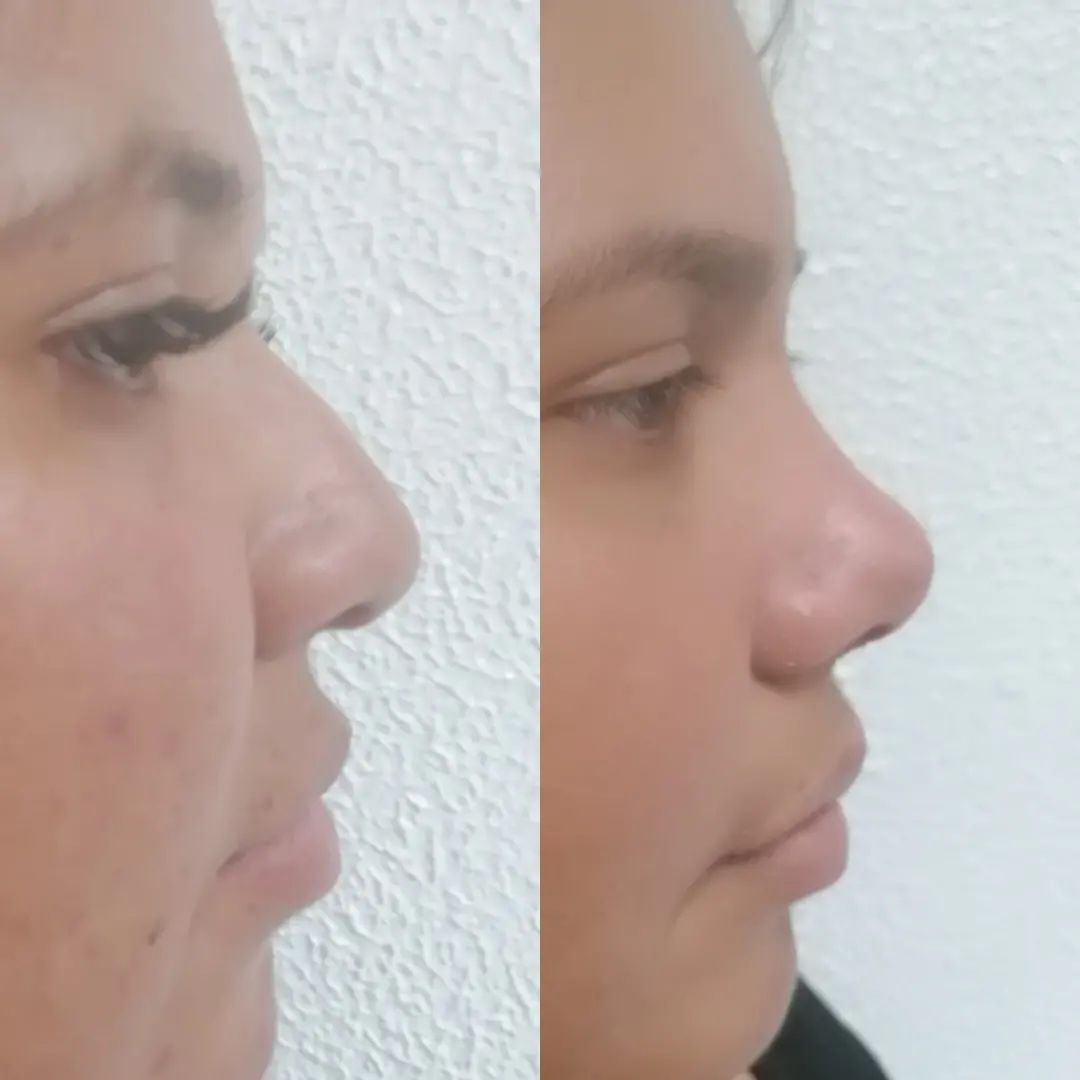 Erendira Santiago Santiesteban-12