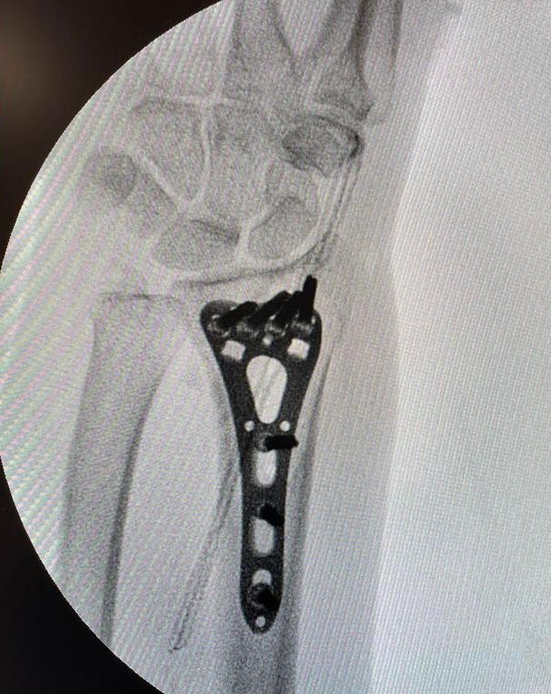 Gisela Cleto Zepeda-89