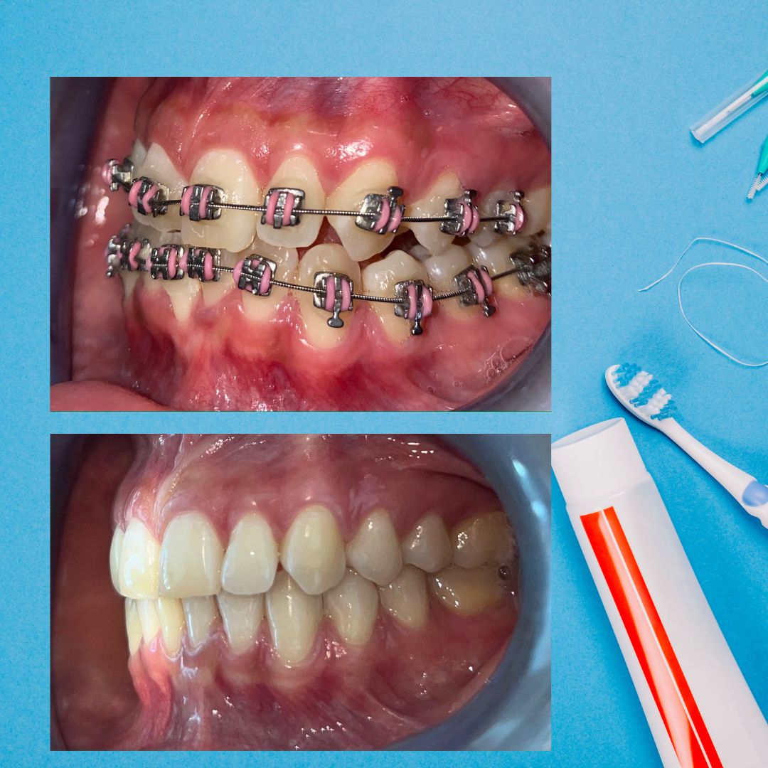 Zuriel Ayala Garcia-0