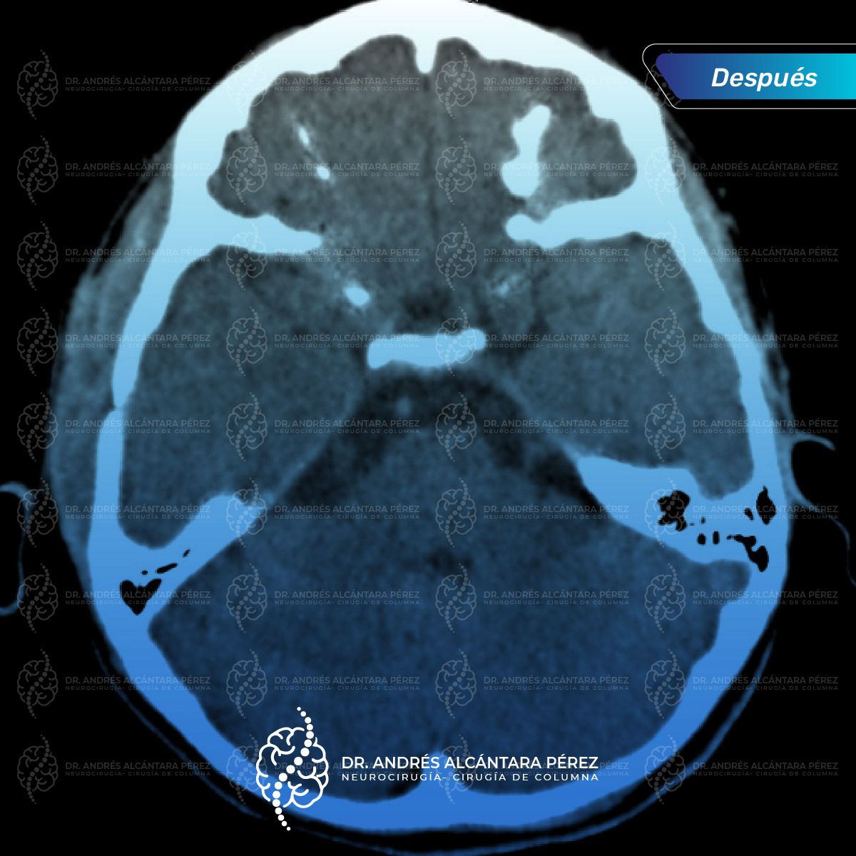 Andres Alcántara Pérez-22
