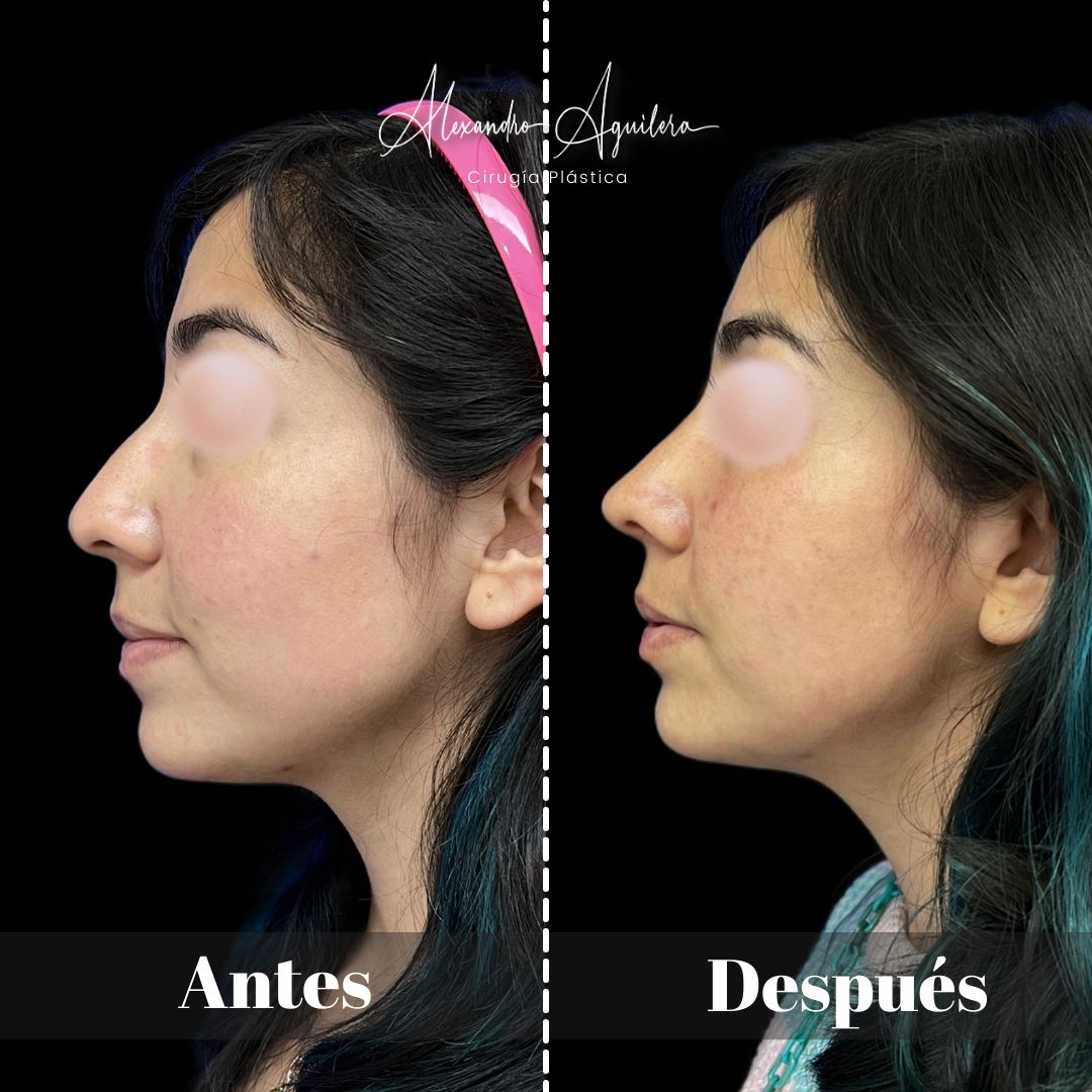 Alexandro Aguilera Salgado-45