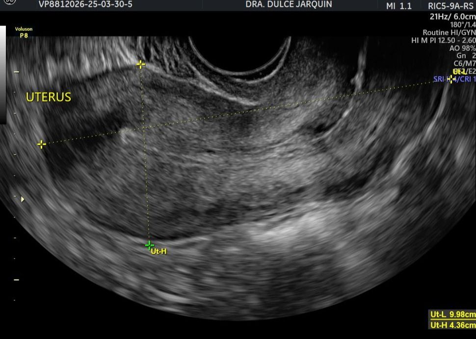 Dulce Anabel Jarquin Arango-27