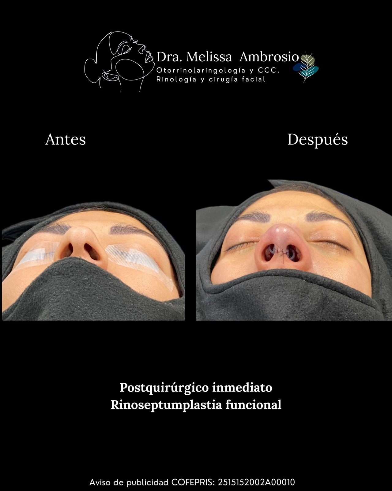 Melissa Guadalupe Ambrosio Mendoza-2