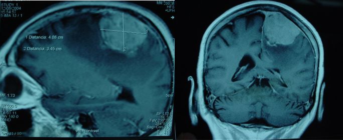 Miguel Adolfo Abdo Toro-1