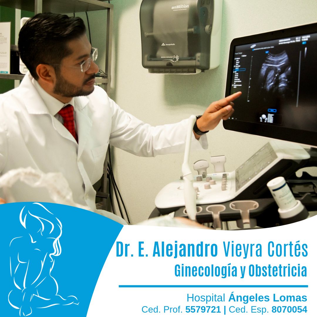 Edmundo Alejandro Vieyra Cortes-3