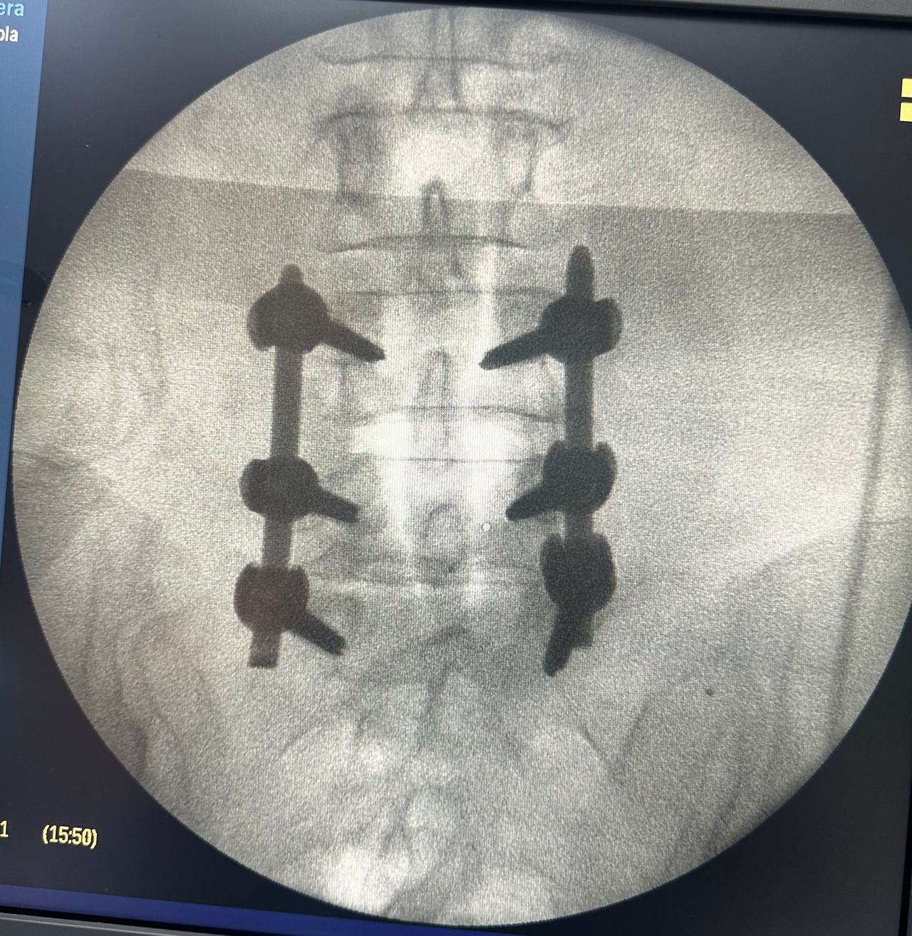 Alejandro Martínez Ramírez-52