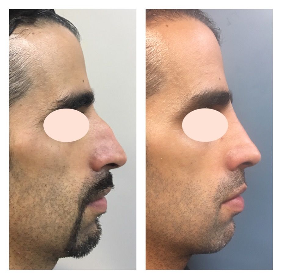 Carola Berenice Curiel Davalos-49