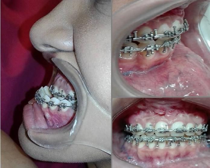 Alberto Wintergerst Fisch-35