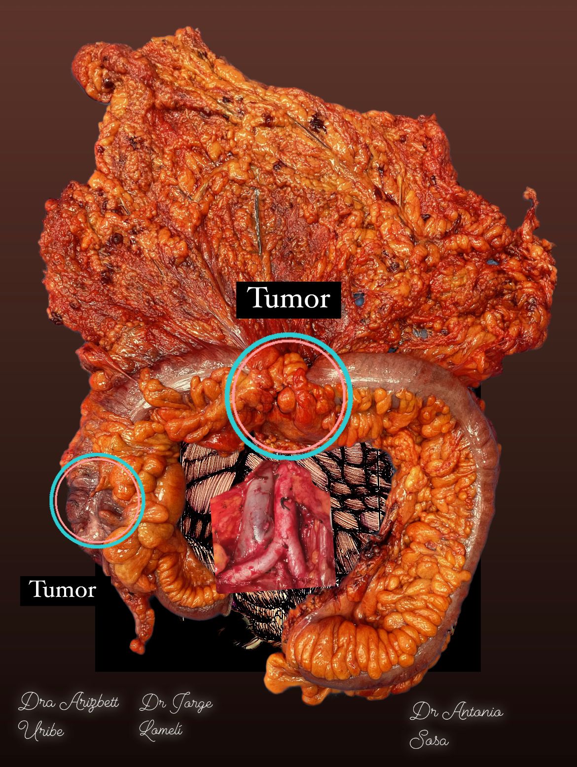 Jorge Antonio Lomeli Muñoz-62