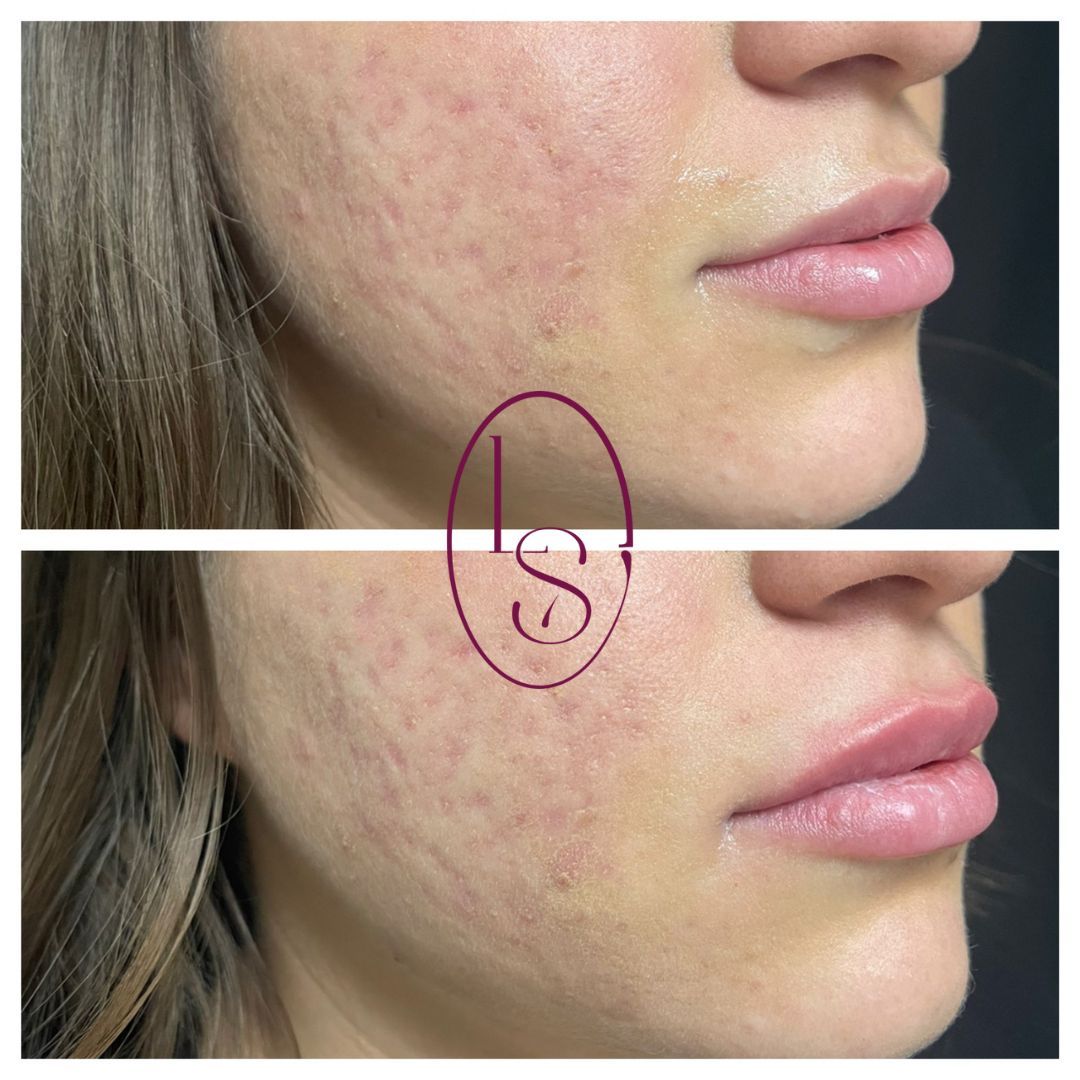 Laura Cristina Sepulveda-3