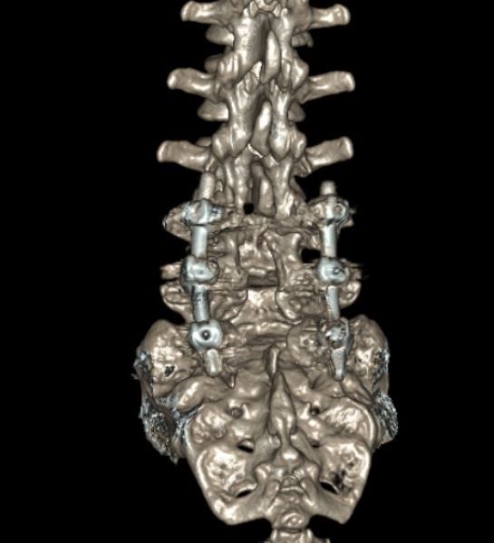 Marco Antonio Díaz Montoya-9