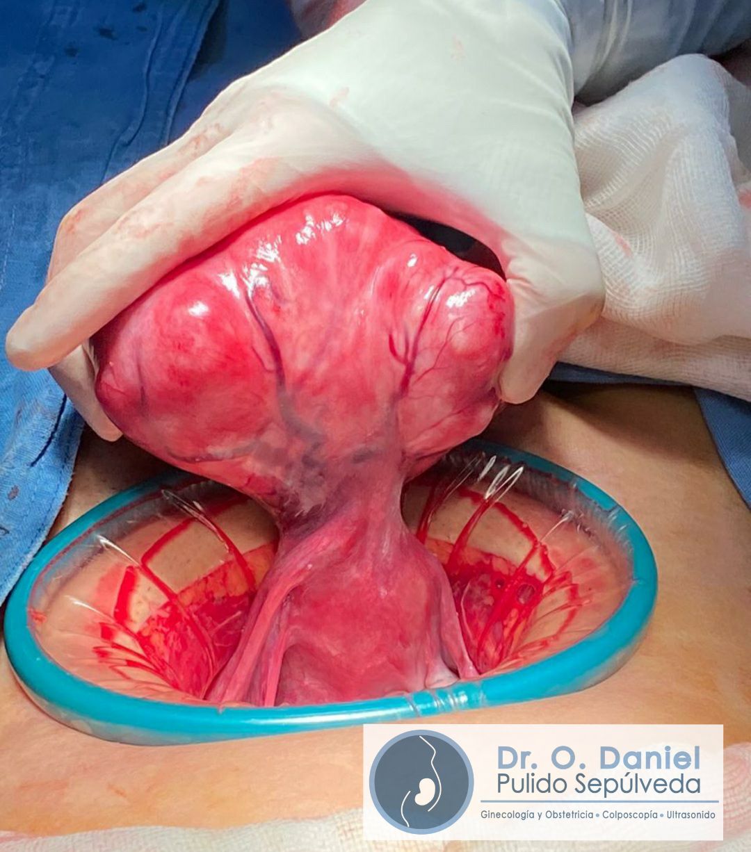 O. Daniel Pulido Sepúlveda-5