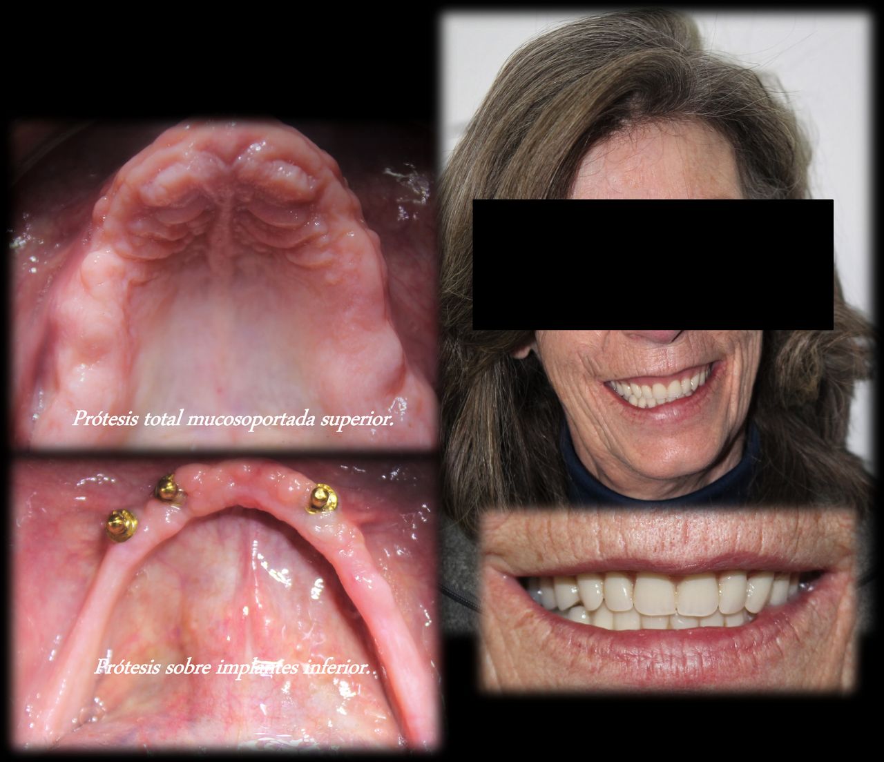 Aimee Valles Monárrez-32