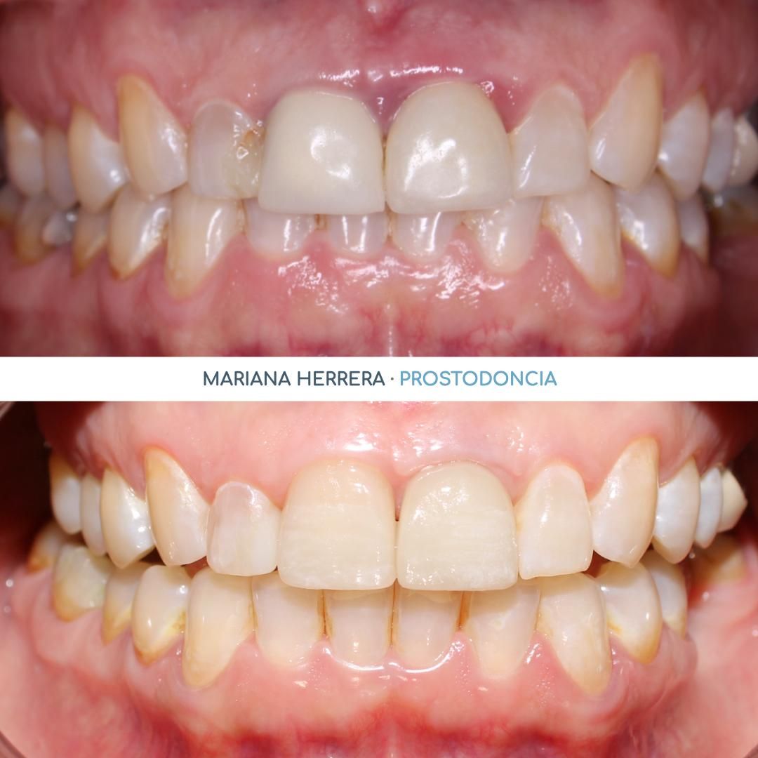 Mariana Herrera Martín Del Campo-16