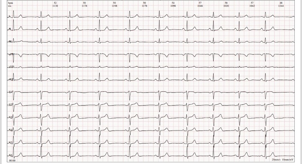 Carlos Enrique Blanco Méndez-5