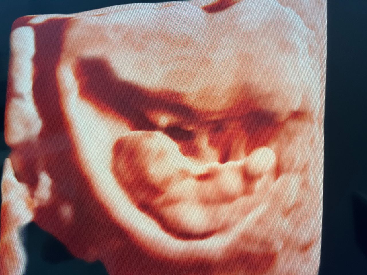 Benjamín Isai Molina Solís-7