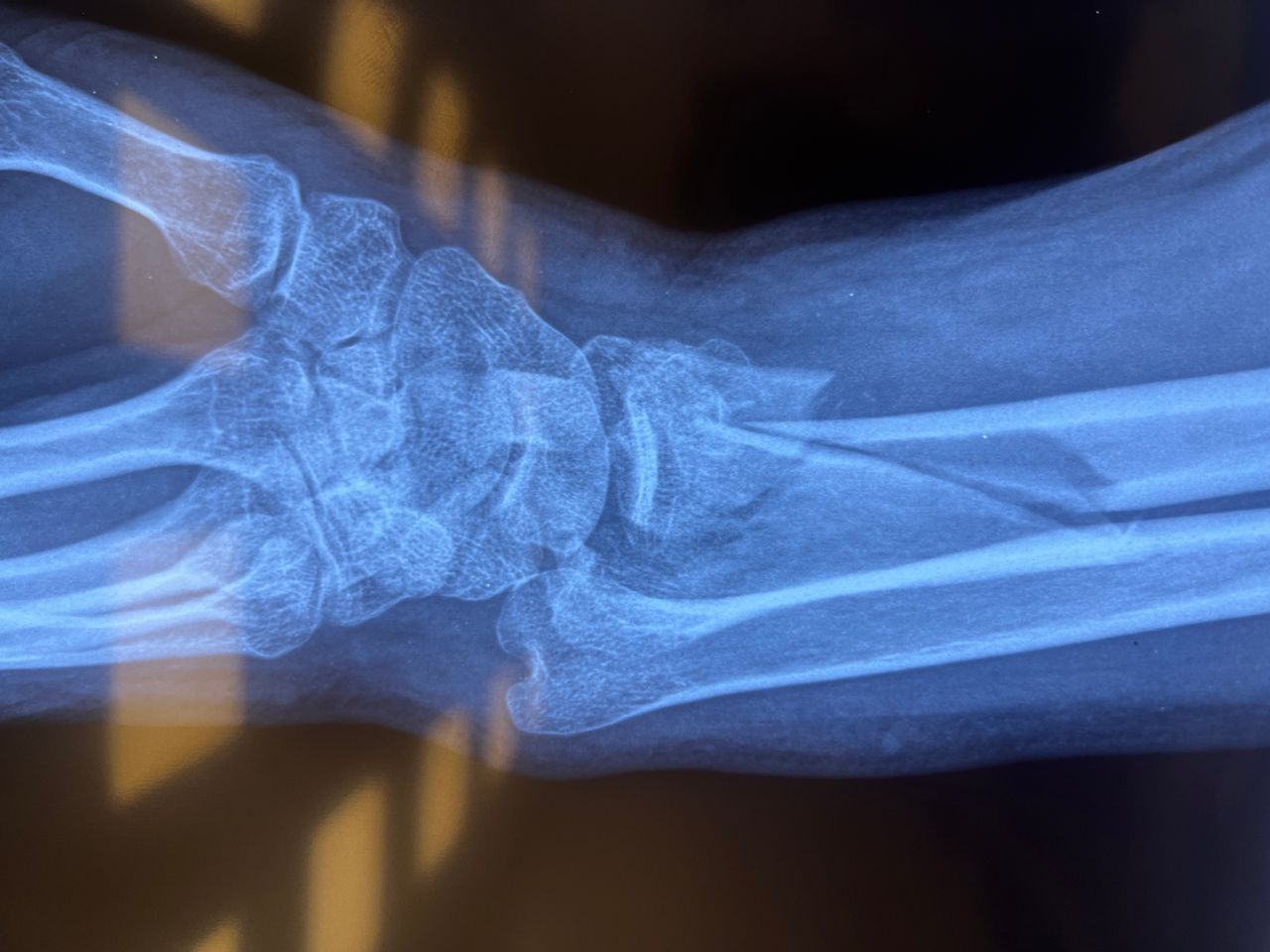 Alberto Lorenzo Cortés-3