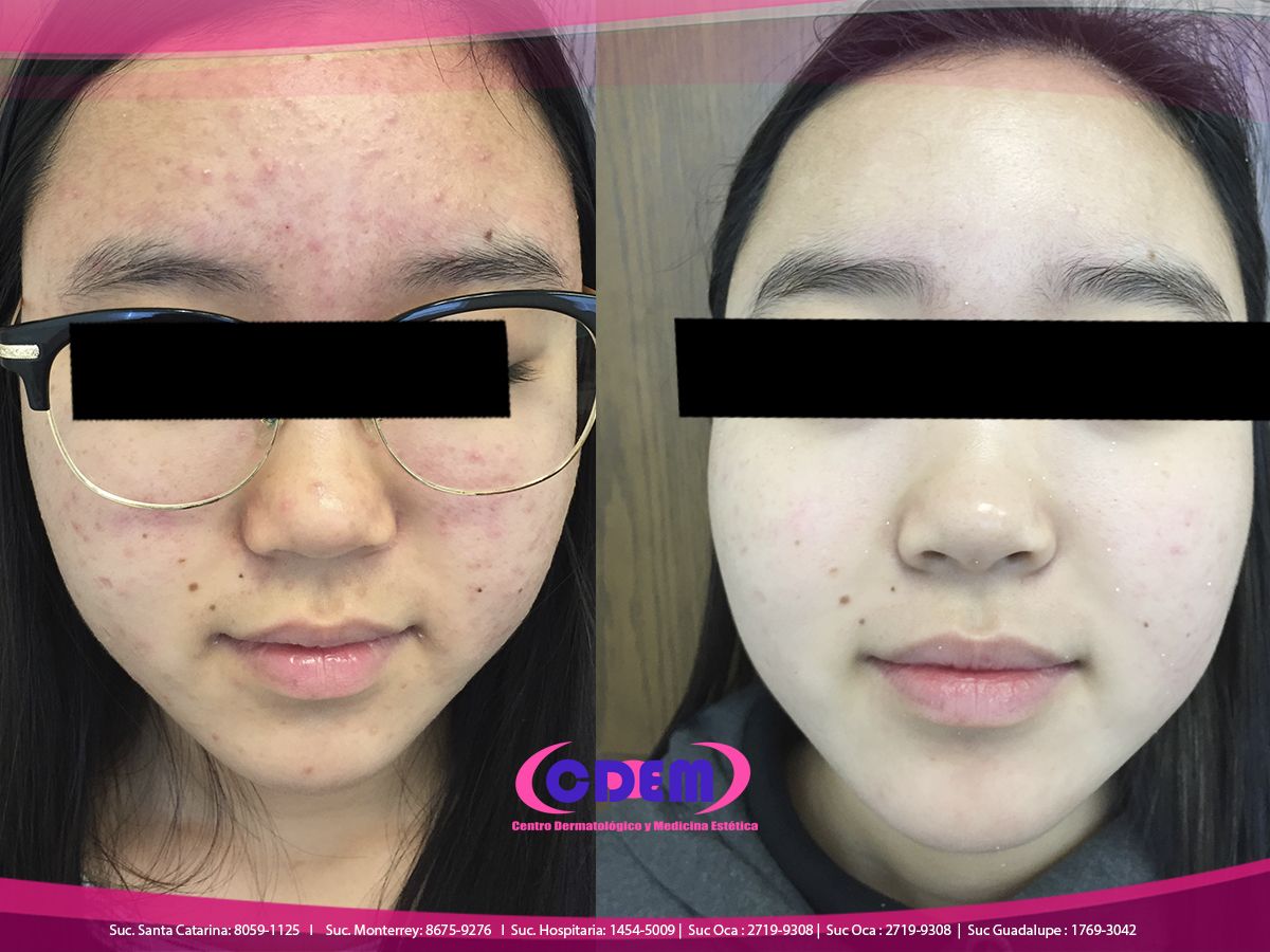 Mercedes Fernández Reyes-9