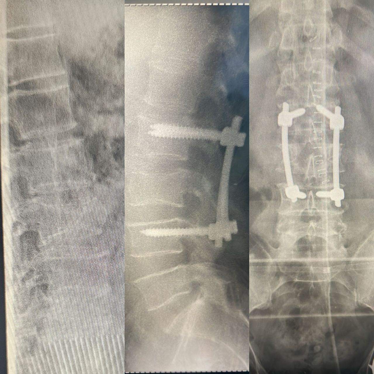 Elías Benjamín Preciado Tovar-2