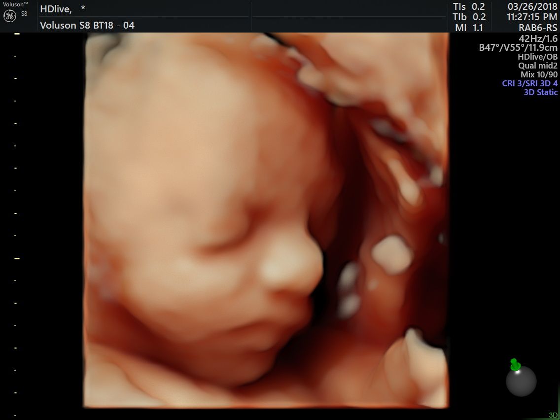 Kenia Militzi Ramírez Campos-7