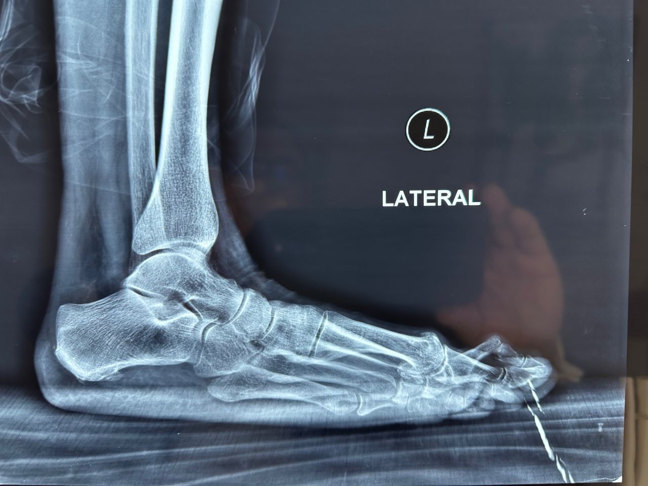 Carlos Ignacio Muñoz Valadez-15