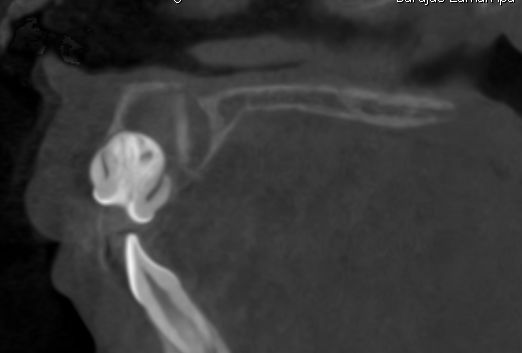 Sergio Fernando García Aguilar-0