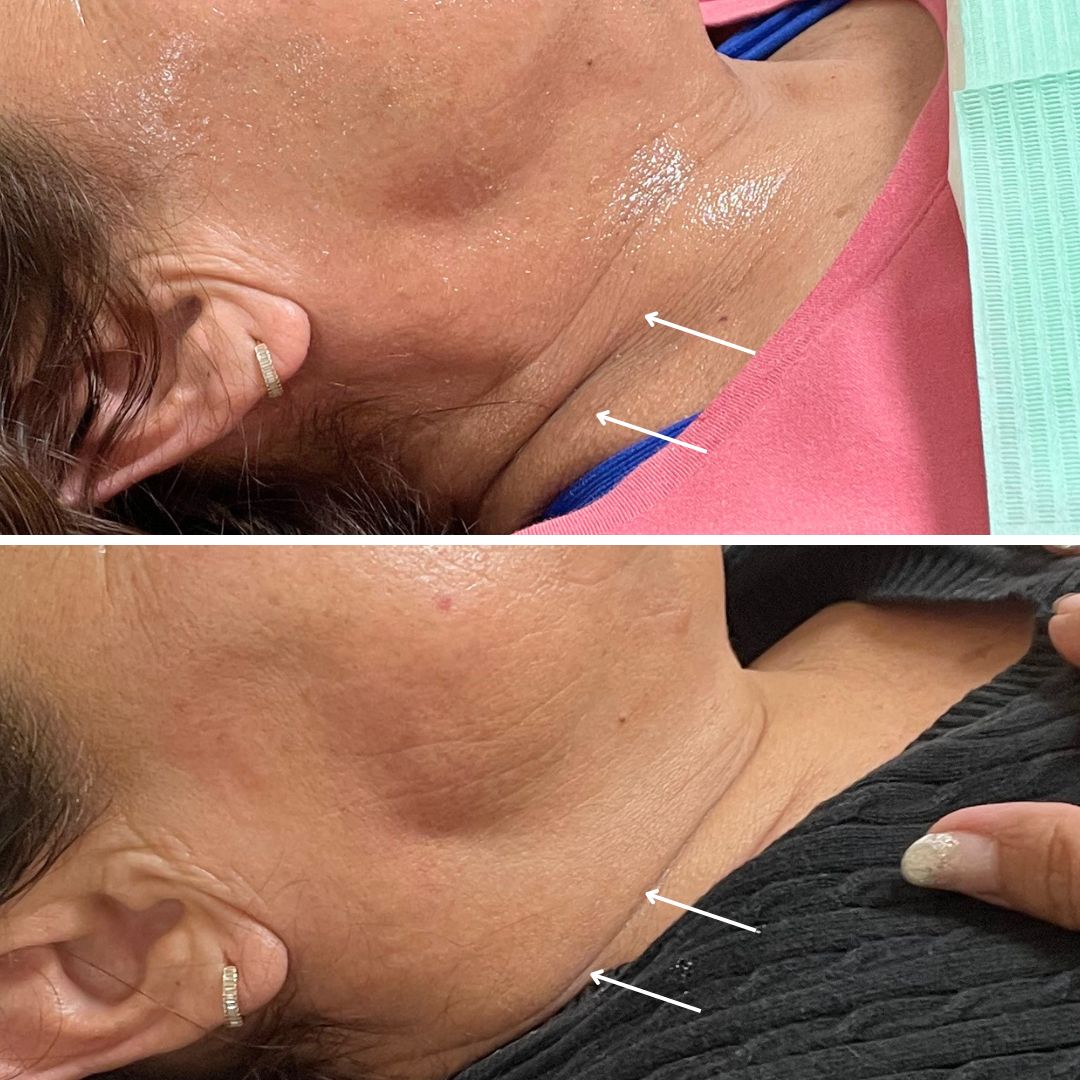 Alejandra Gutierrez García-25