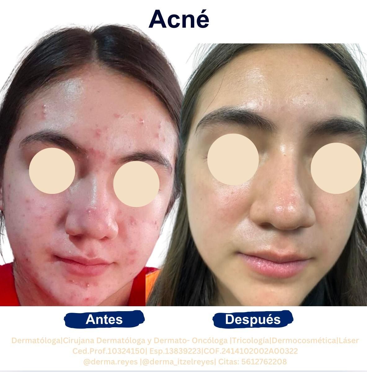 Itzel Anayn Flores Reyes-6