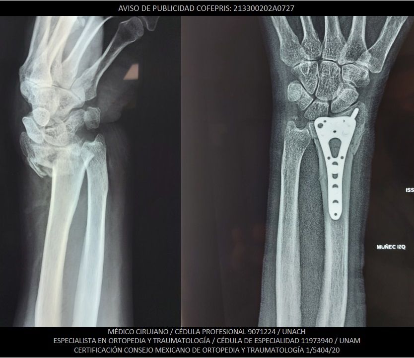 Luis Castañón Robles-18