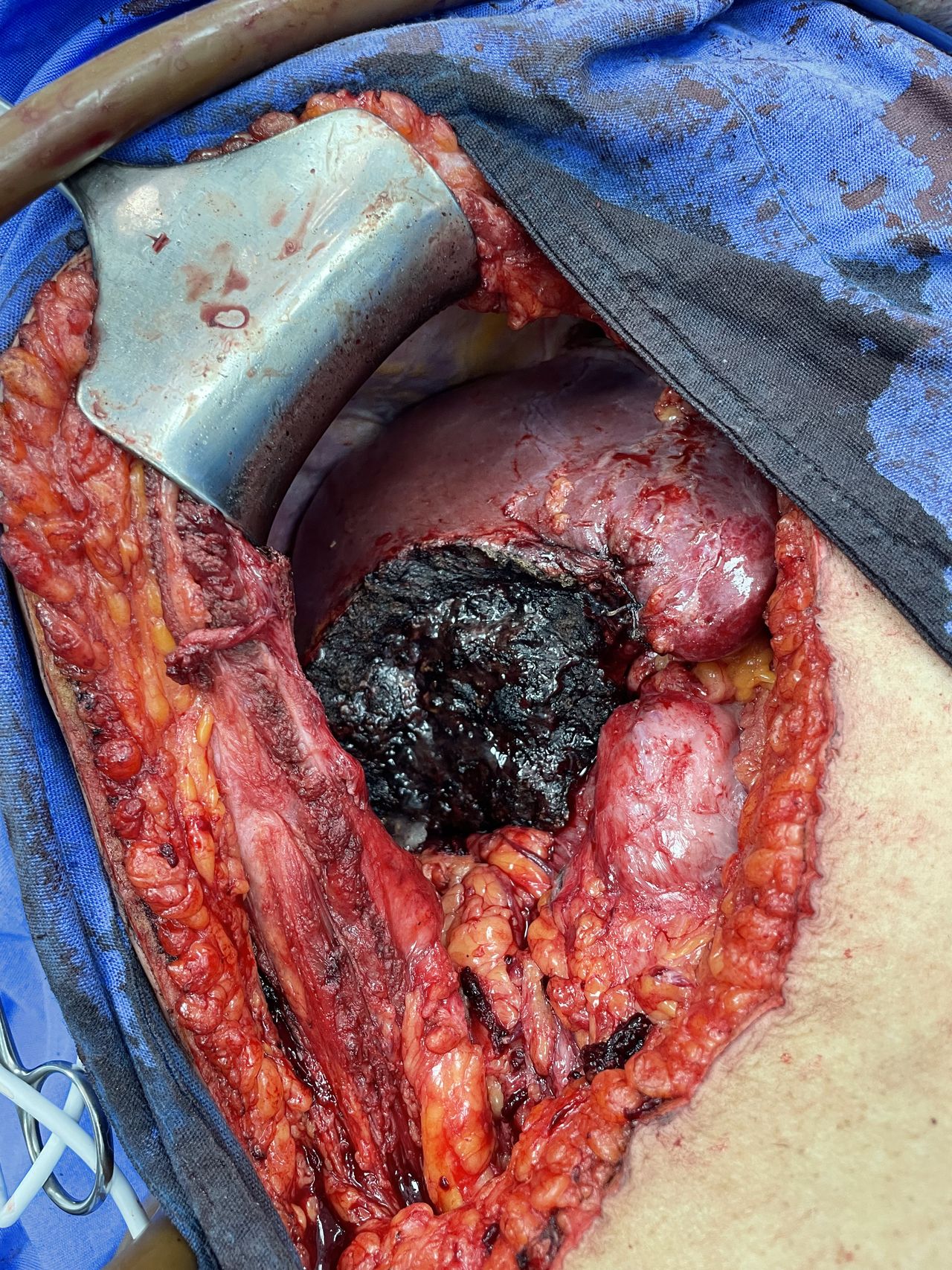 Jorge Antonio Lomeli Muñoz-81