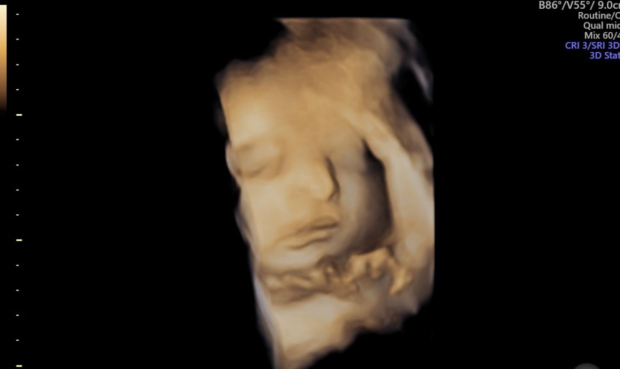 Angélica Mireles Garcia-0