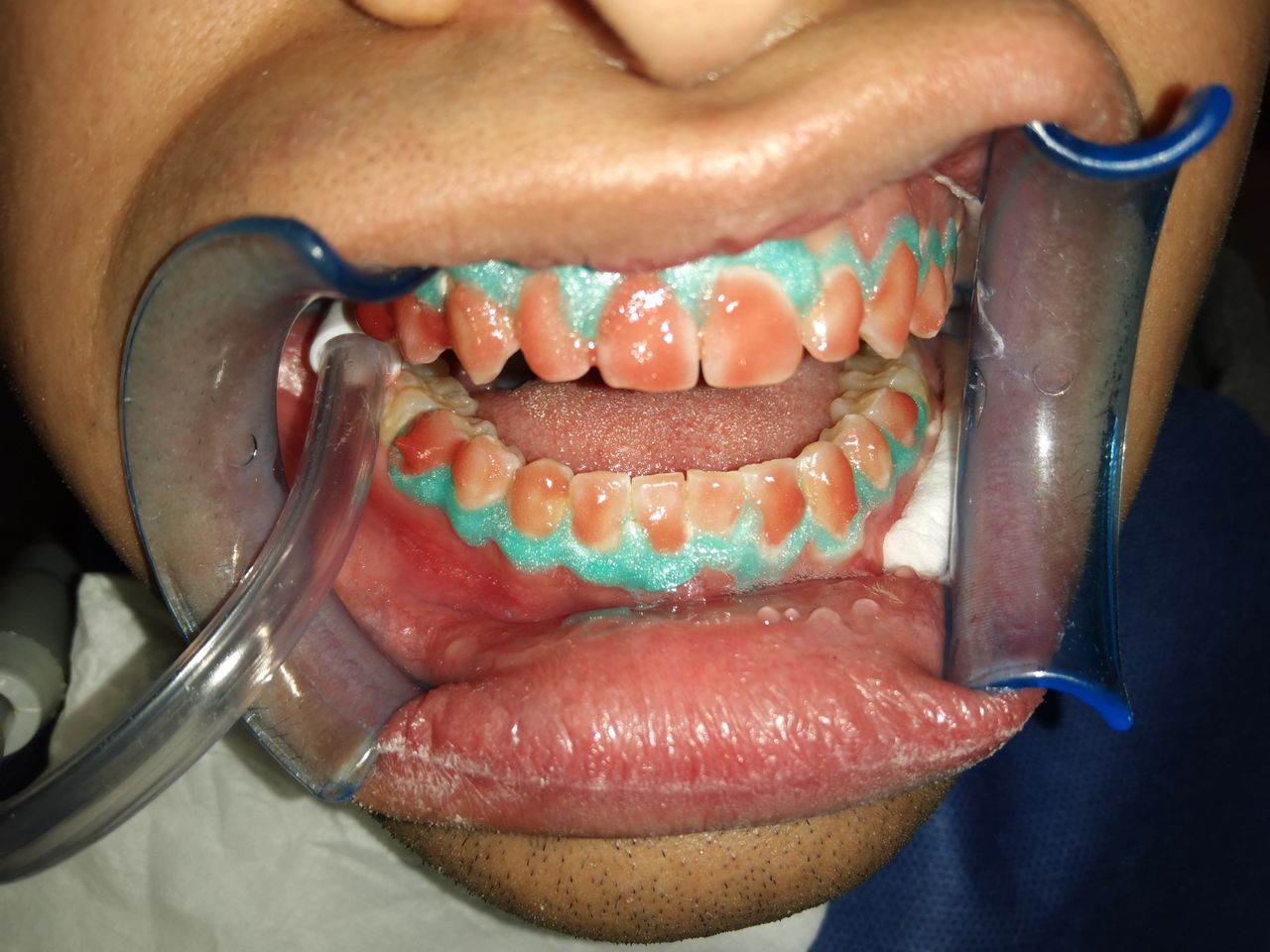 Alejandro Alcocer Flores-21