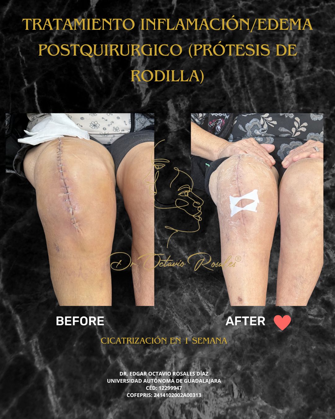 Edgar Octavio Rosales Diaz-13