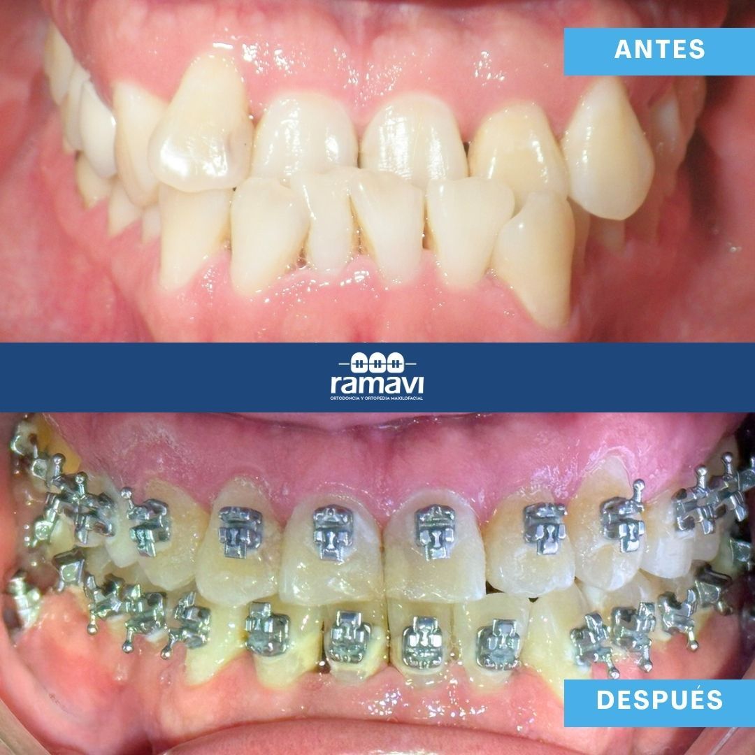 Ramon Mayorga Villeda-3