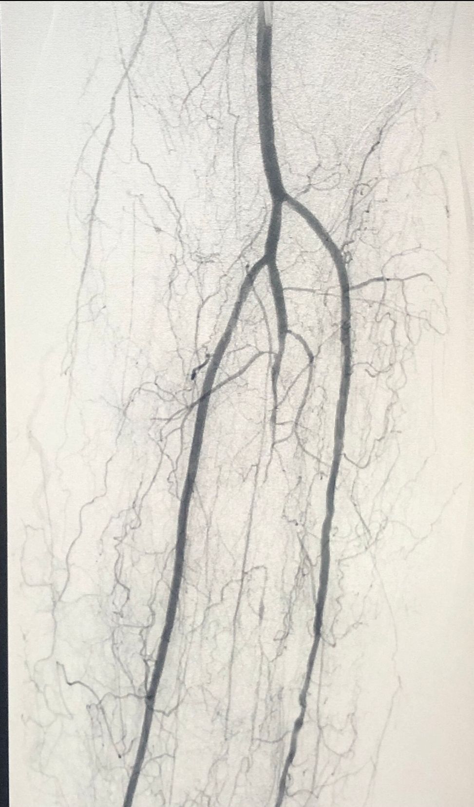 Miguel Abraham Lara Perez-8